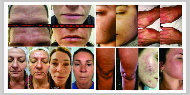 Client Results - Before and After